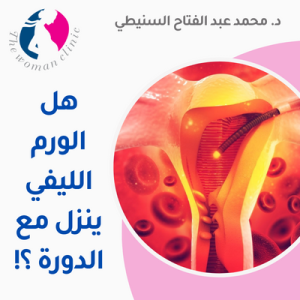 هل الورم الليفي ينزل مع الدورة 
