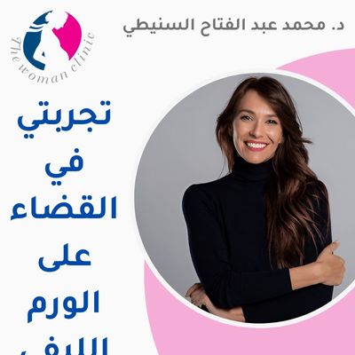 تجربتي في القضاء على الورم الليفي – 5 معلومات هامة