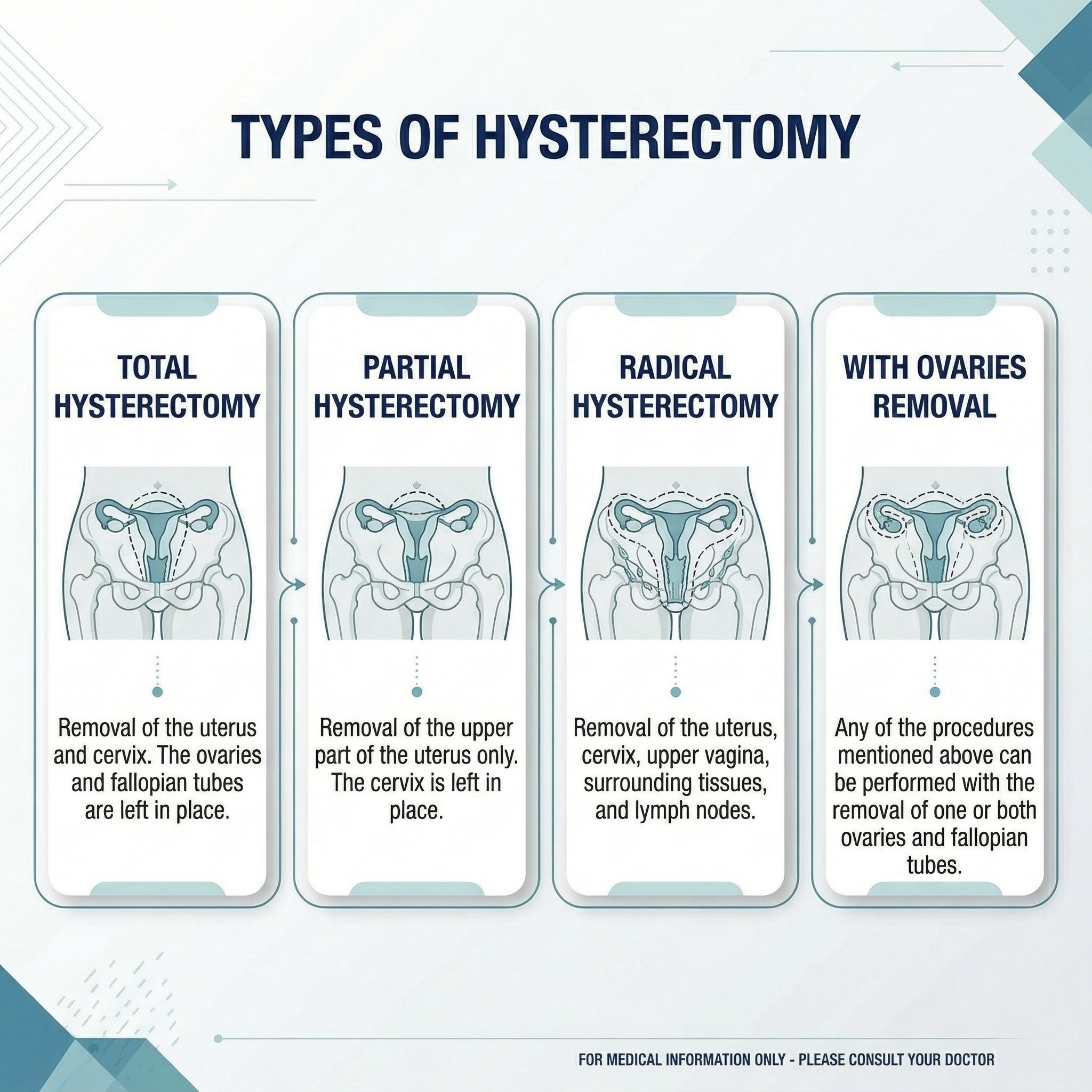 Types of Hysterectomy Infographic